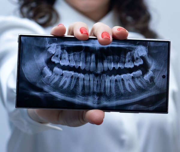 Una radiografia panoramica dei denti sullo schermo di un telefono